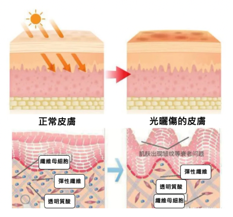 【γ-PGA聚麩胺酸鈉】比玻尿酸強10倍的保濕王者！幫妳肌膚自體製造長效保濕，由內而外誕生天使光圈肌