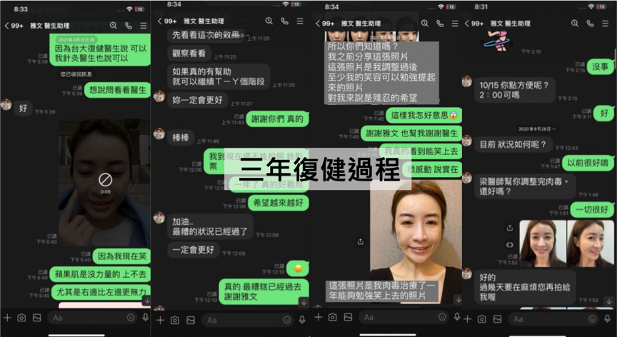 【我的真實醫美修復紀錄】選對醫生很重要！從點線面進行4D全臉矯正，我推薦梁仲斌醫生的全面性醫學美容治療