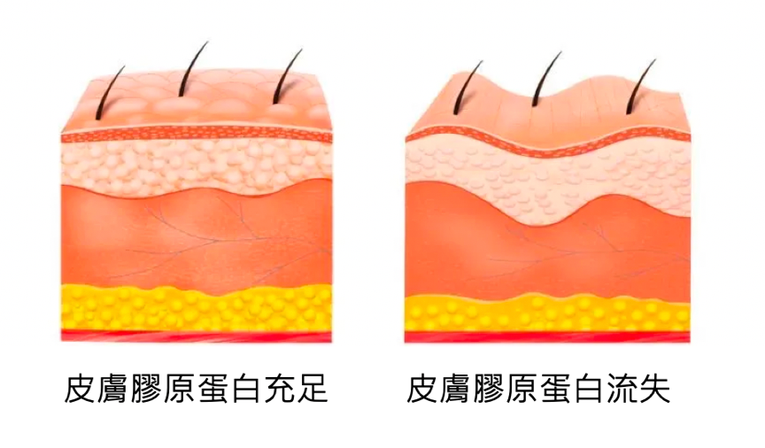 補充膠原蛋白的最棒的方式就是「自體生長膠原蛋白」，這與注射生長因子在肌膚真皮層有著密切的關聯，讓妳皮膚的細胞被重啟！