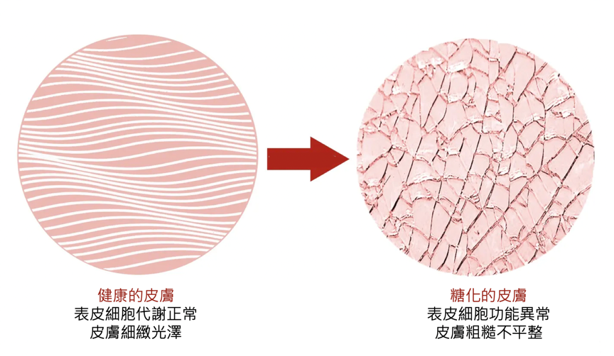 臉垂、皺紋多、粉刺痘痘長不停，都是因為妳有「糖化臉」！皮膚過糖化造成的10大問題