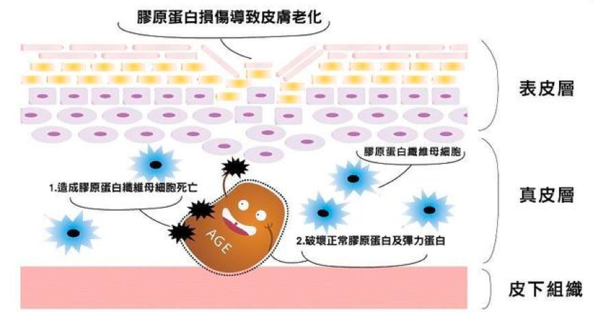 臉垂、皺紋多、粉刺痘痘長不停，都是因為妳有「糖化臉」！皮膚過糖化造成的10大問題