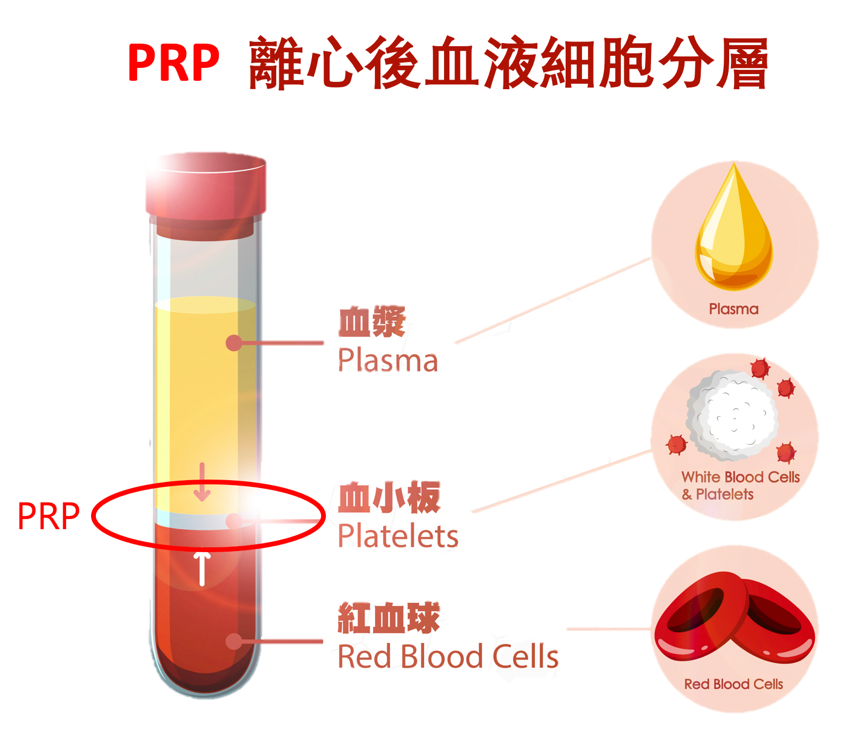 重拾青春逆齡肌膚就靠「PRP生長因子療法」賦活再生肌源 讓妳肌膚新生速度遠超老化受損