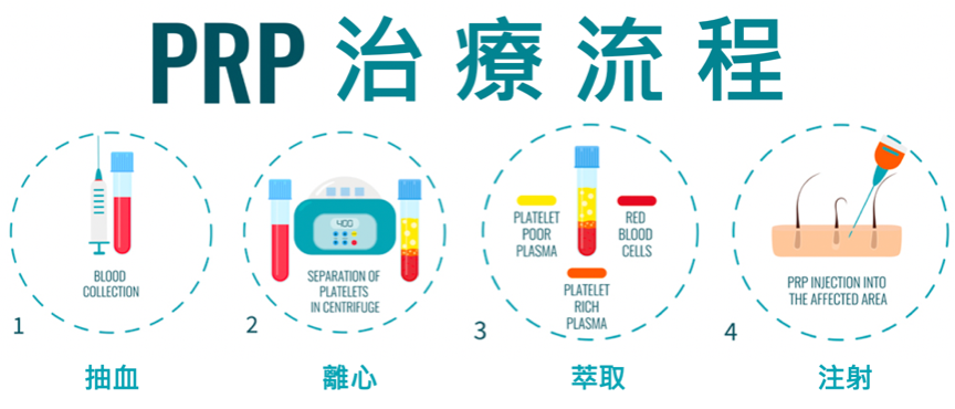 「PRP療程」啟動血管超速修復力！9大生長因子喚醒血管新生，從肌底激活膠原蛋白增生