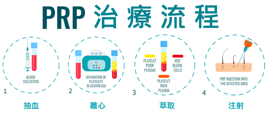 重拾青春逆齡肌膚就靠「PRP生長因子療法」賦活再生肌源 讓妳肌膚新生速度遠超老化受損