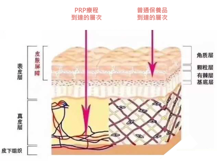 「PRP療程」啟動血管超速修復力！9大生長因子喚醒血管新生，從肌底激活膠原蛋白增生