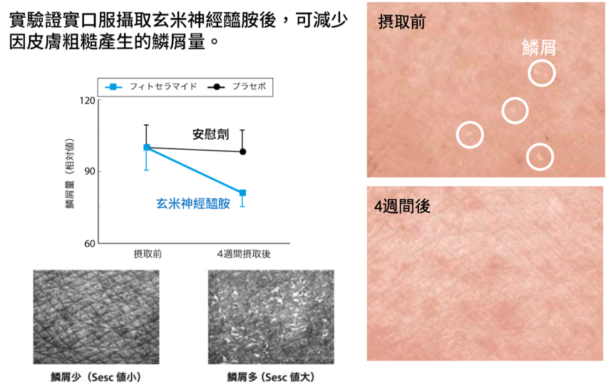 神經醯胺口服有效嗎？神經醯胺功效全攻略！吃出素顏自帶女神光，打造肌膚強效防護盾