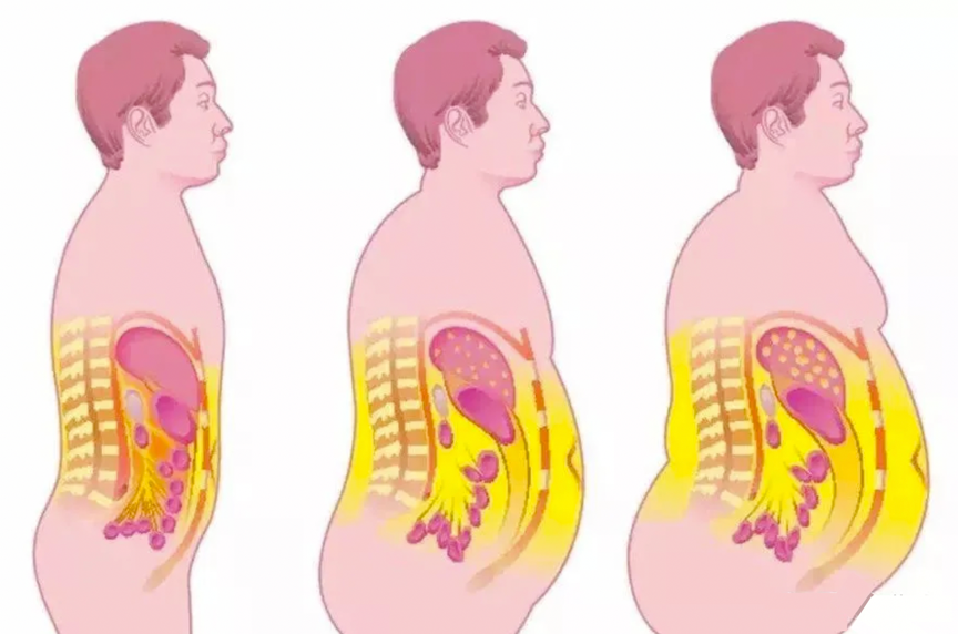 懂這招「燃燒內臟脂肪」輕鬆減重 別再讓過量脂肪塞住妳的肝臟、胰臟！